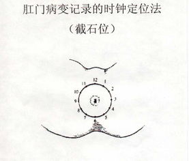 喝了白酒大便出血，喝了白酒拉大便就出血了
